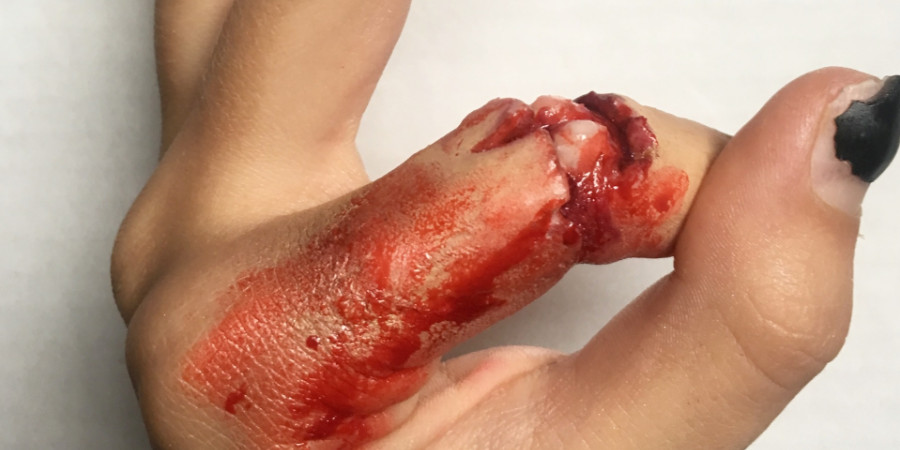 broken knuckles by Chantal Lofstrom special effects makeup showcase